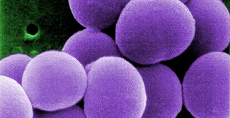Gli oli essenziali efficaci per combattere i super-batteri