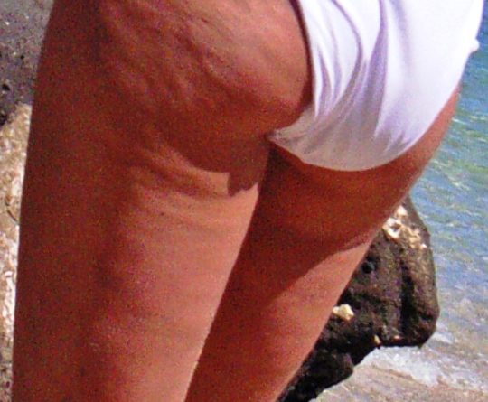 Combattere la cellulite con gli oli essenziali